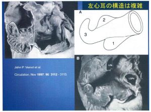 図３　左心耳の構造