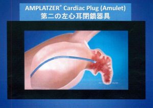 図８A　Amplatzer Cardiac Plug